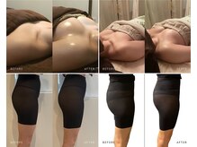 チエミ(Chi e mi)の雰囲気（【バスト＆ヒップアップメニュー有】引締め効果・美脚効果も★）