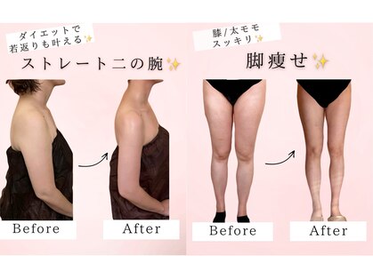 シャルロット(Charlotte)の写真