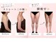 シャルロット(Charlotte)の写真