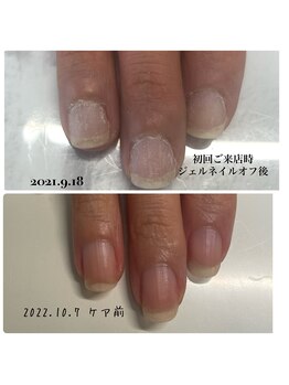 エクラプラス(Eclat.plus)/爪は変わります