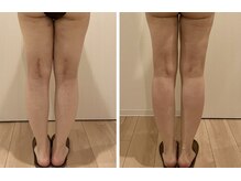 ルミノ 心斎橋(Rumino)/術後ケア