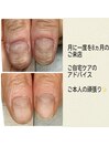 お爪でお困りの方