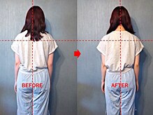 アトラス/初回のお客様のBefore＆after