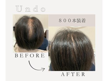 アンドゥ(Undo)/分け目が目立ってきたらコレ！
