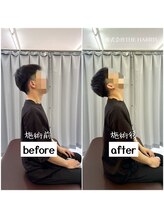 由利本荘整体院/施術ビフォーアフター（首）