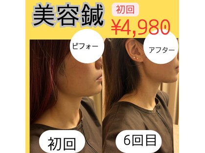 フィエール(fier)の写真