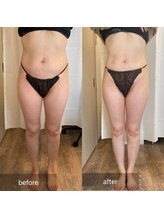 ナイスデイ(Niceday!)/下半身痩身