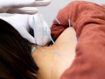 望鍼灸院/肩こり専門鍼灸