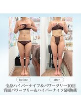 エスプレッソ(espresso,)/【全身痩身】体重5キロ減！！