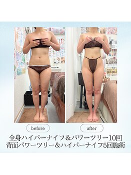 エスプレッソ(espresso,)/【全身痩身】体重5キロ減!!