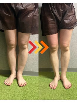 ヴィオラプラス(violla Plus+)/美脚リンパ 初回価格¥2800