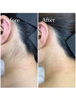 ホワイトワックス 京都四条烏丸(WHITE WAX)/《うなじ》スッキリ◎