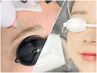 アイブロウデザイン脱毛&全顔脱毛♪¥10,000