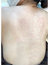 リベル 名古屋(Lebelle:)/ハーブピーリング専門名古屋