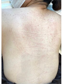 リベル 名古屋(Lebelle:)/ハーブピーリング専門名古屋