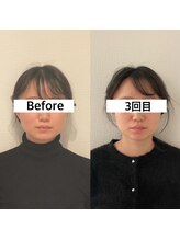 アンドリードット 堀江(&re.)/３回目ビフォーアフター!