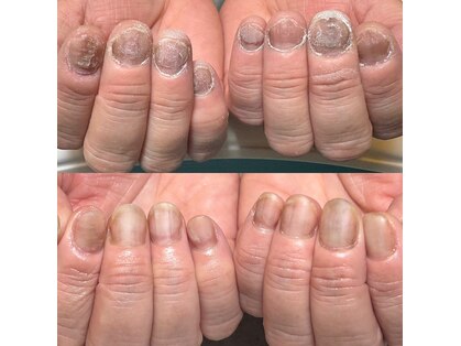 ハッカネイル(HAKKA NAIL)の写真