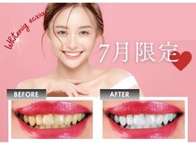 エクシアホワイトニング 新百合ヶ丘店