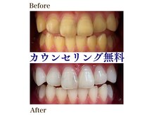 ホワイトニングショップ 妙高店(whiteningshop)の雰囲気（セルフホワイトニング♪短期集中ケアで理想の白さを実現！！）