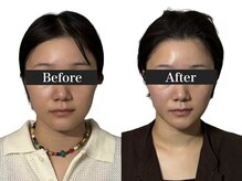 オアシス トウキョウ 心斎橋(OASIS TOKYO)/