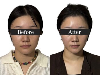 オアシス トウキョウ 心斎橋(OASIS TOKYO)/