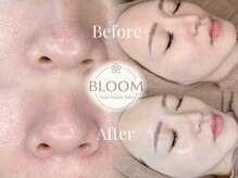 BLOOM(恵比寿)のメンズ眉毛サロン