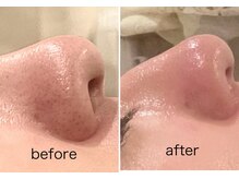 マリアージュ(Le Mariage)の雰囲気（毛穴ケア）