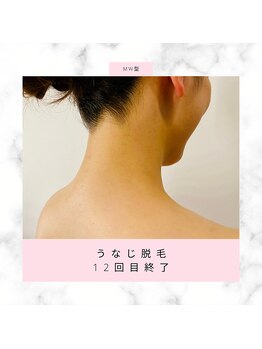 華/うなじ脱毛
