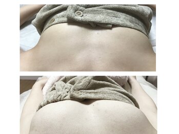 ファミリーセルフサロン 輪(Wa)/セルフ/フォト美顔/バストケア/