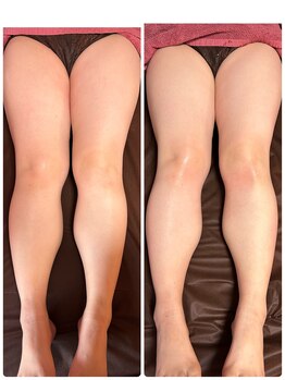 ビマリア(美-MARIA)/デトックス美BODY 痩身