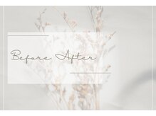 ネイル アンチュ(Nail Anchu)/Before　After