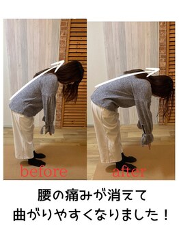 千葉駅前腰痛整体院/曲げるのが楽になりました