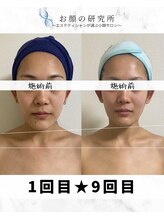 お顔の研究所/ビフォーアフター写真♪
