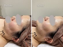 エリー(Ellie)/結婚式前直前1回プラン♪