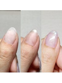 アクリルスカルプ長さ出し