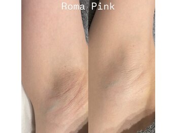 リ クリニカル ラボ(Re clinical Labo)/ローマピンクBody