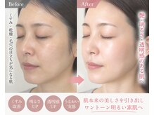 ルナ クレッシェンテ(Luna crescente)/老け見え肌を短時間で一気に解消