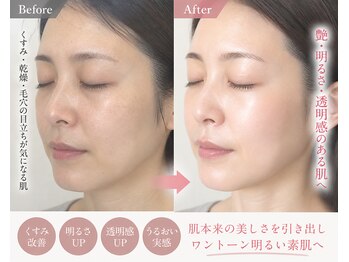 ルナ クレッシェンテ(Luna crescente)/老け見え肌を短時間で一気に解消