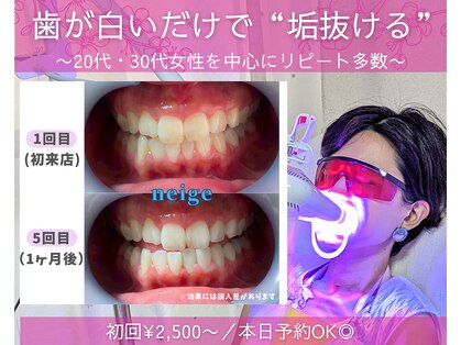 ネージュ(neige)の写真