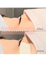 アイラッシュサロントナリ(TONARI)/パリジェンヌ