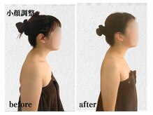 オトサロン(Otosalon)/寝ながら小顔に！