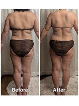 フィニシオン/40代　4回施術後ろ姿スッキリ