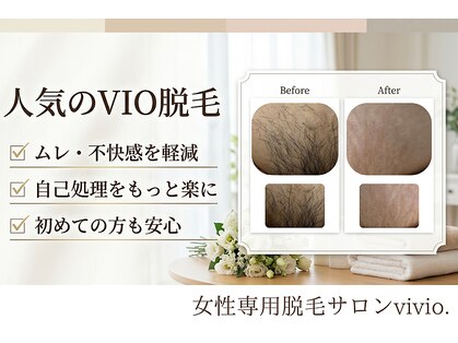 ヴィヴィオドット(vivio.)の写真