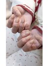 Handnail