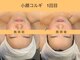 オプレア 栄店(OPREA)の写真/当店人気NO.1◇小顔コルギ¥5500◎肩甲骨周り、デコルテも一緒に行い老廃物の排出を促進するので効果UP♪