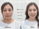 サラ デ ミレ(Sala de milae)の写真/貴方のわがままに全力でお応え★種類豊富なメニューでキレイをお手伝い♪お客様の雰囲気に合わせてご提案☆
