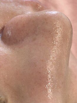 クッカ(kukka)/韓国式３D毛穴洗浄