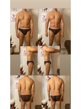 京橋メンズビューティーラボ(KMB LAB.)/ハイパーナイフのbefore/after