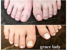 グレースレディ/可愛い足元！