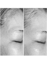 ラ ジェム(La gemme)/【シミシワへもアプローチ◎】